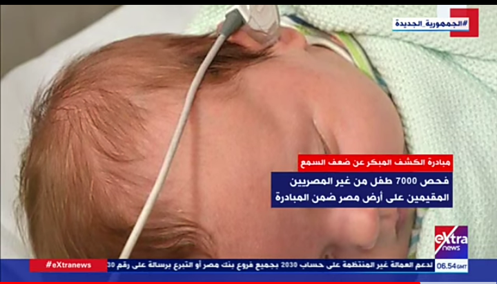 مبادرة رئيس الجمهورية للكشف المبكر وعلاج ضعف وفقدان السمع للأطفال حديثي الولادة